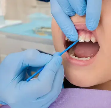 a child undergoing dental check up