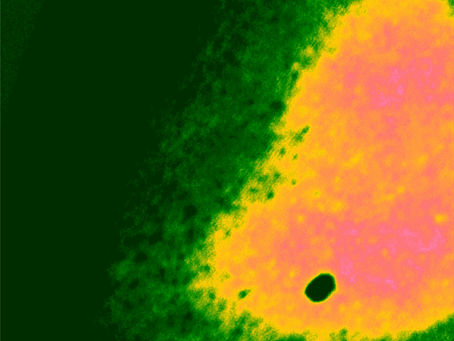 After using Lifewave Patches (all patches from Gold variety pack, used twice)…