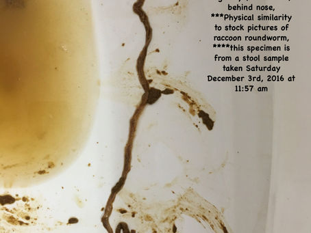 Laboratory at Women’s College Hospital can’t find worms in worm filled stool samplesR