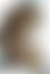 After tonsilectomy, teeth cleanings, overflossing, throat/tongue surgery to remove cancer…