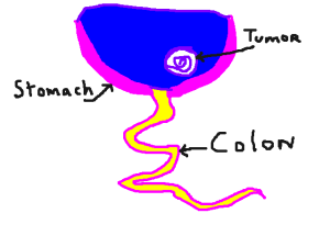 stomach