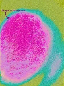 Here is what the look for malignancy edit looks like in Lunatic, see blog post for more how to...