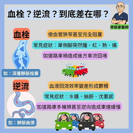 靜脈 曲張 血栓