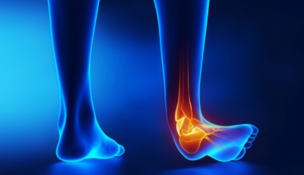 Tratamiento esguince de tobillo | Vlinder Center: Fisioterapia DF | México