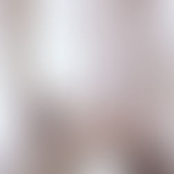 ¿Por qué aparece la fibrosis cicatrizal?