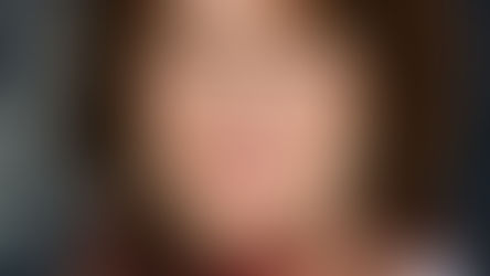 Doreen Schuett RN, BSN Discusses Our Liquid Facelift