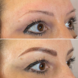 Before and After Microblading