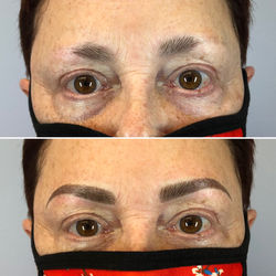 Before and After Microblading