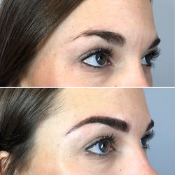 Before and After Microblading