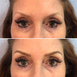 Before and After Microblading