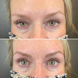 Before and After Microblading