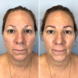 Before and After Microblading