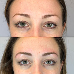 Before and After Microblading