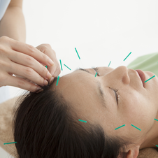 Facial/Cosmetic Acupuncture
