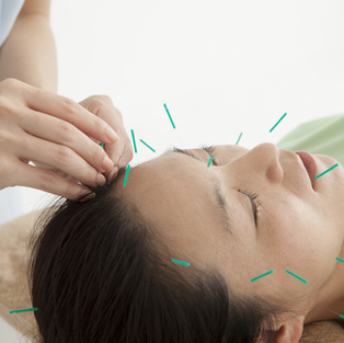 Facial/Cosmetic Acupuncture