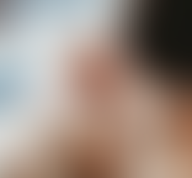 Rhesus Disease: The Mother-Baby Blood Clash