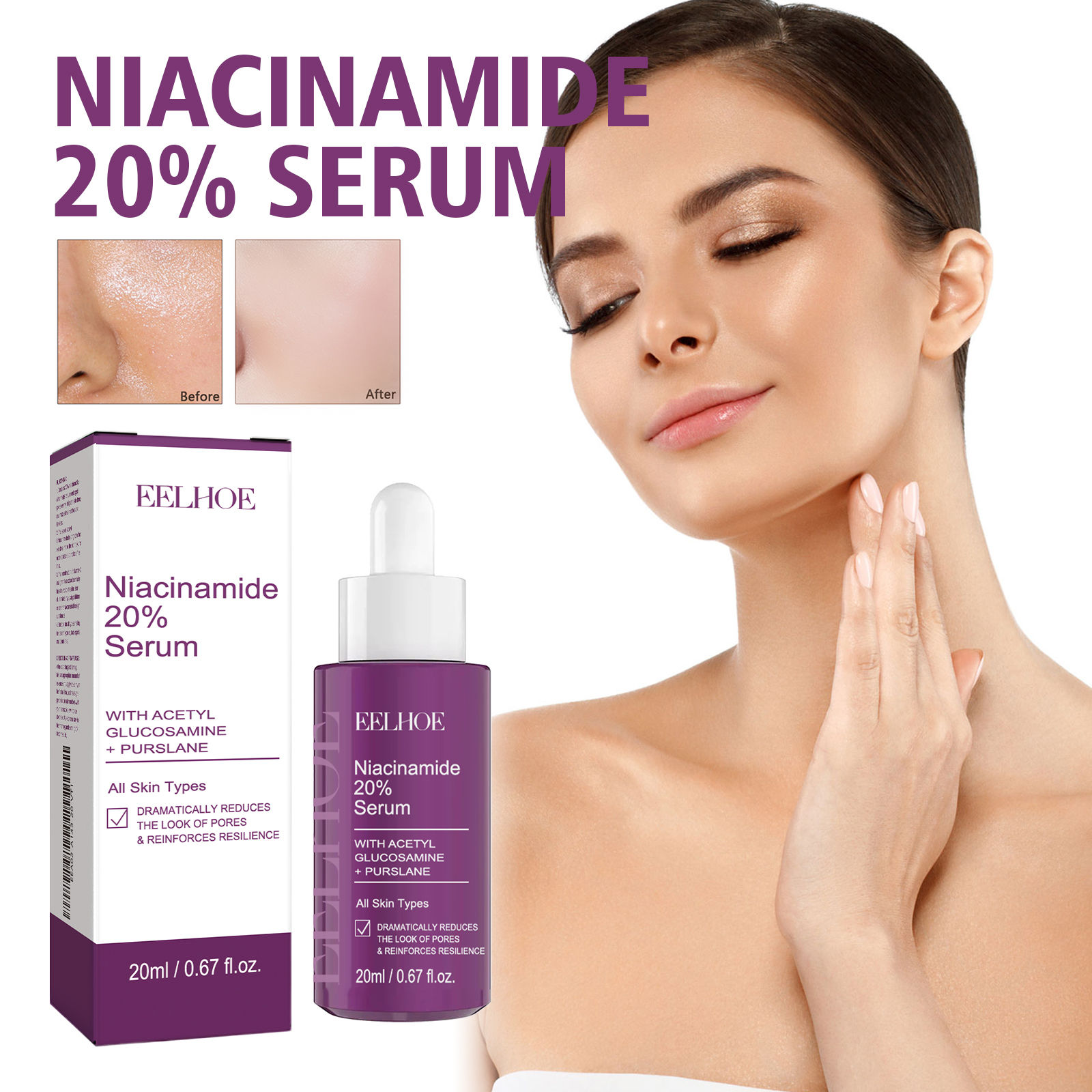 Niacinamide 20% Radiance Serum