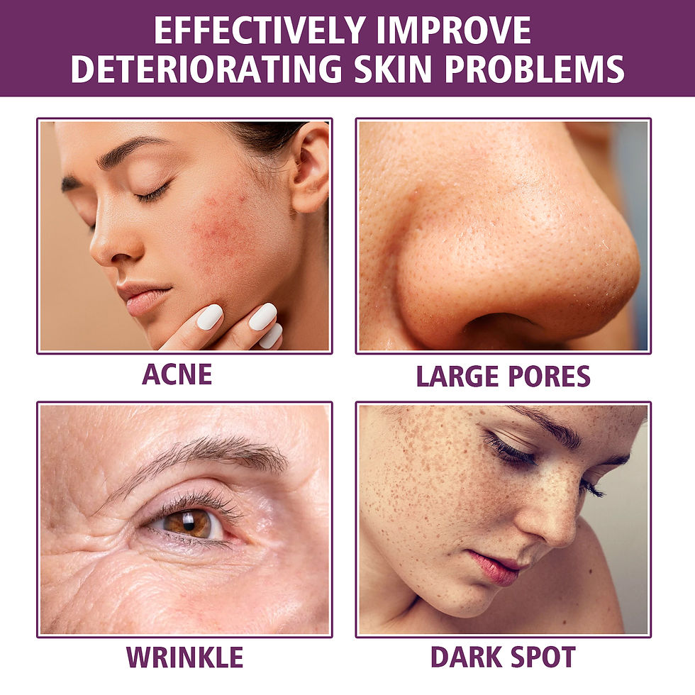 Thumbnail: Niacinamide 20% Radiance Serum