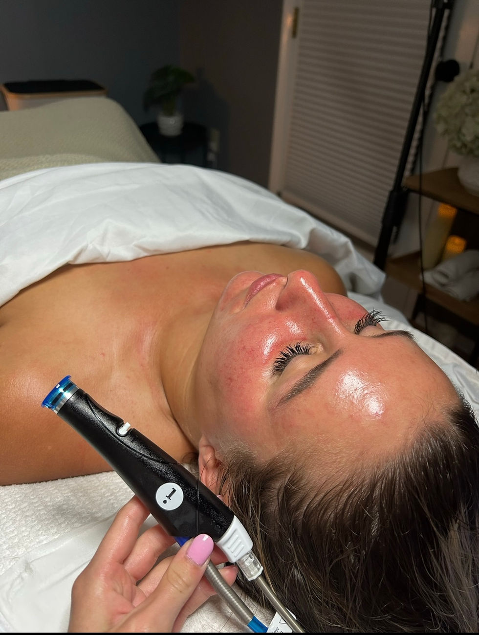 Hydrafacial