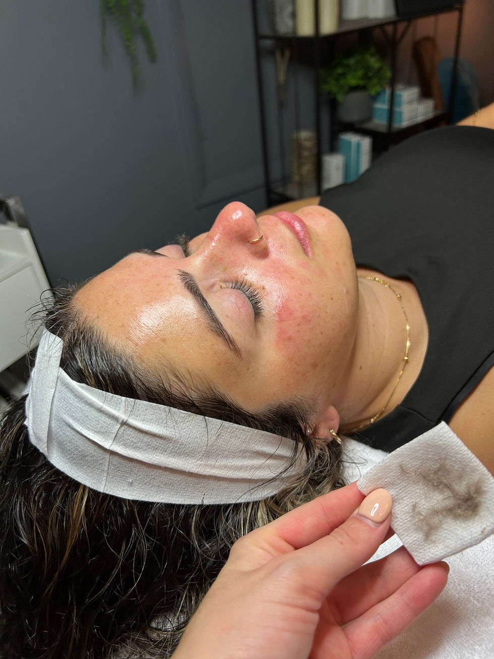 Hydrafacial
