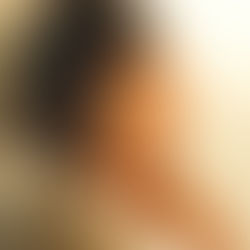 【デスクワークによる女性の肩こり】痛み指数10→0へ