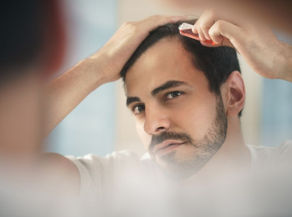Tratamientos capilares para hombres