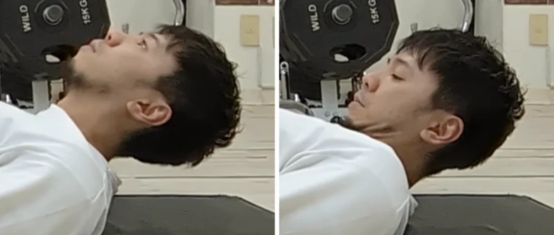 ストレートネック