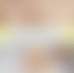 2024 不可不知的最強超越皮秒去斑方法