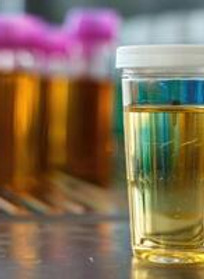 Urine Testing.jpg