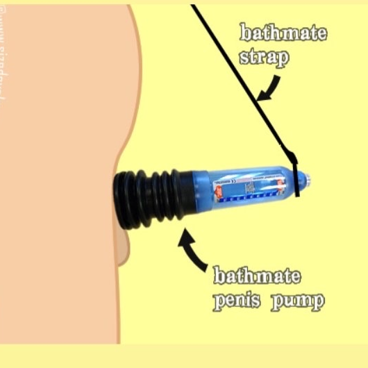 Thumbnail: Bathmate hydromax shower strap