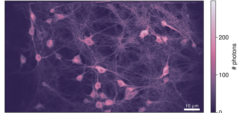neurones_DiV14_bain_MQAE-1.png