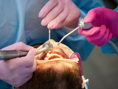 What Happens Before,During,and After a Root Canal Treatment