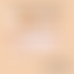 my "vb-mapp" journey 