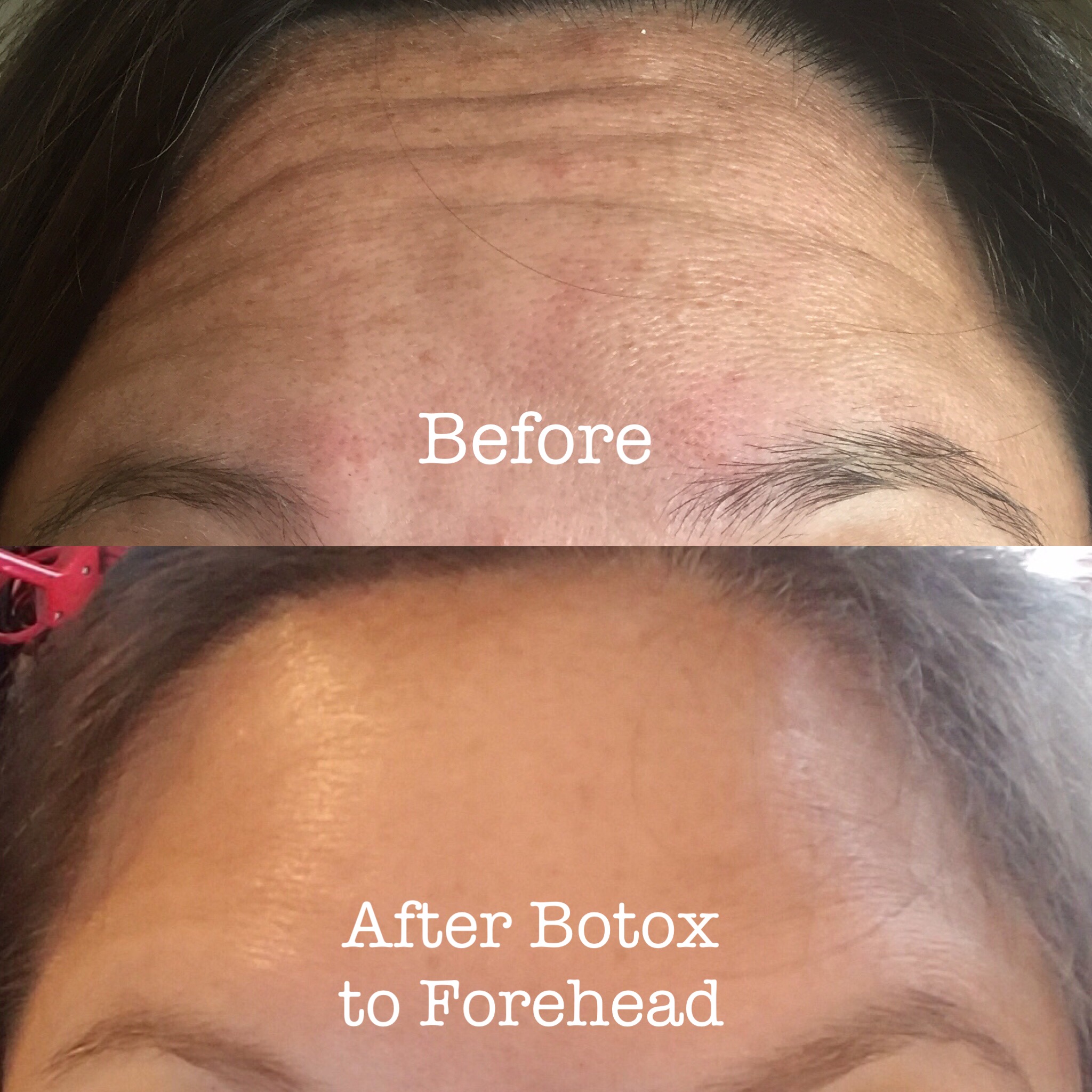 bye bye wrinkles
