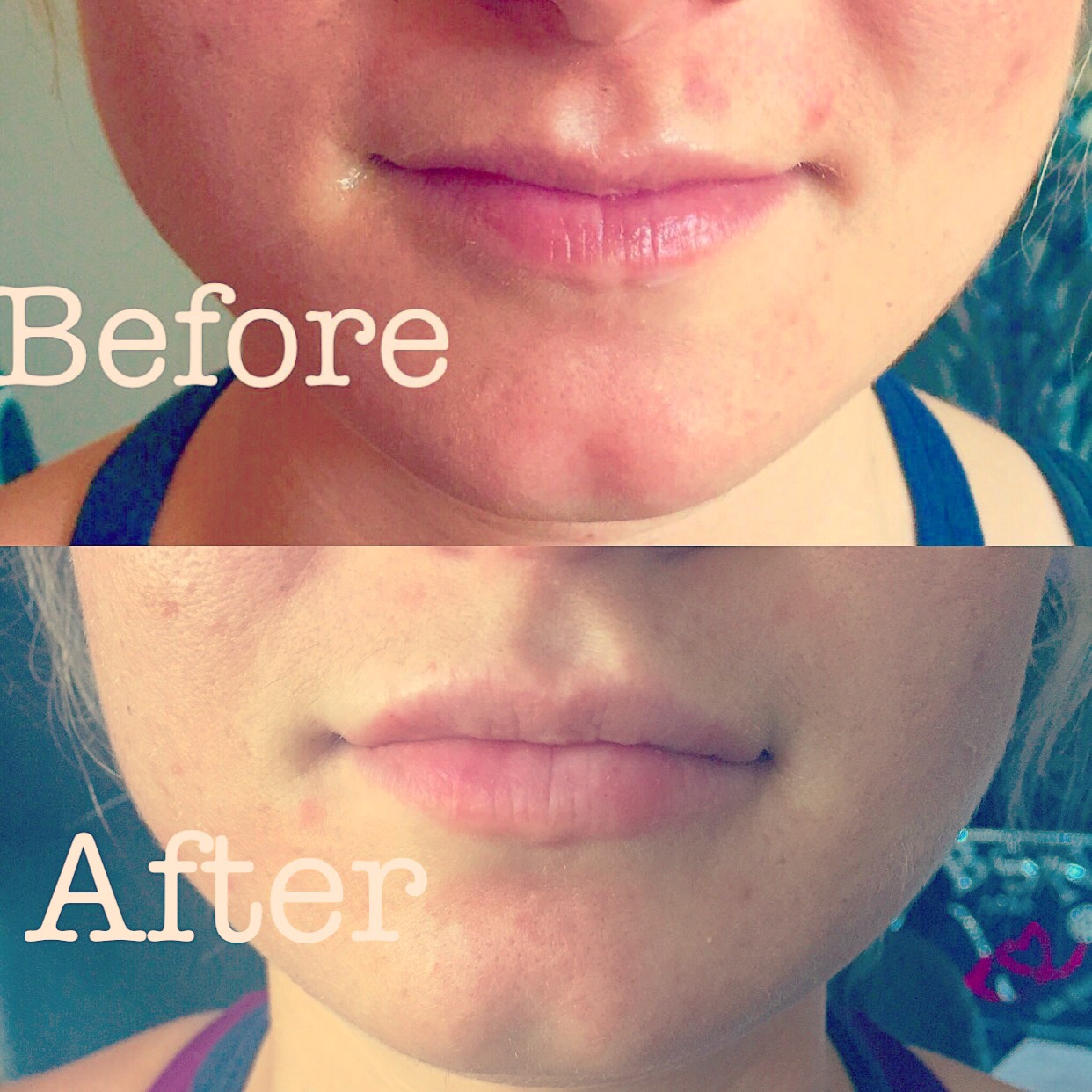 full beautiful lips!