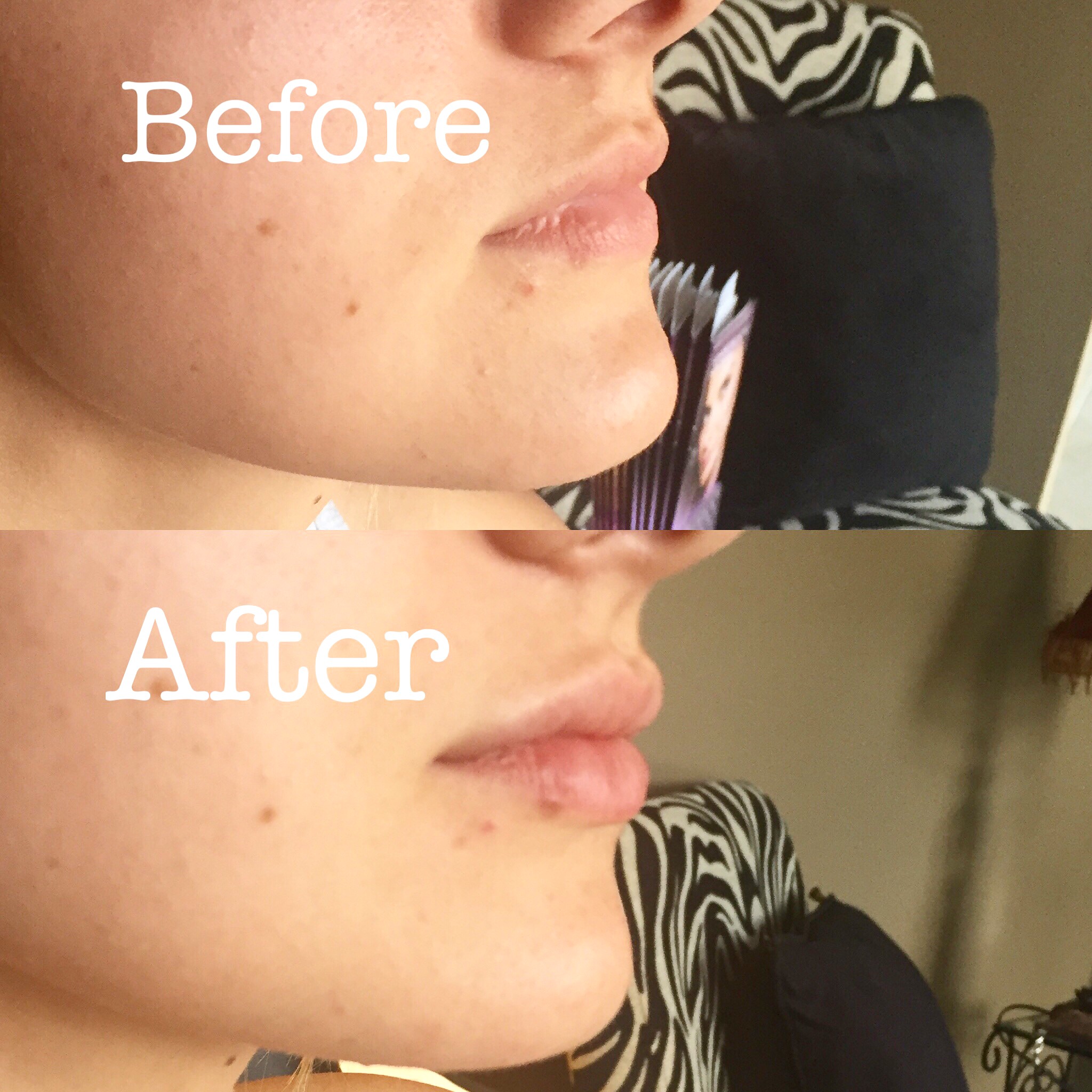 Side view before and after!
