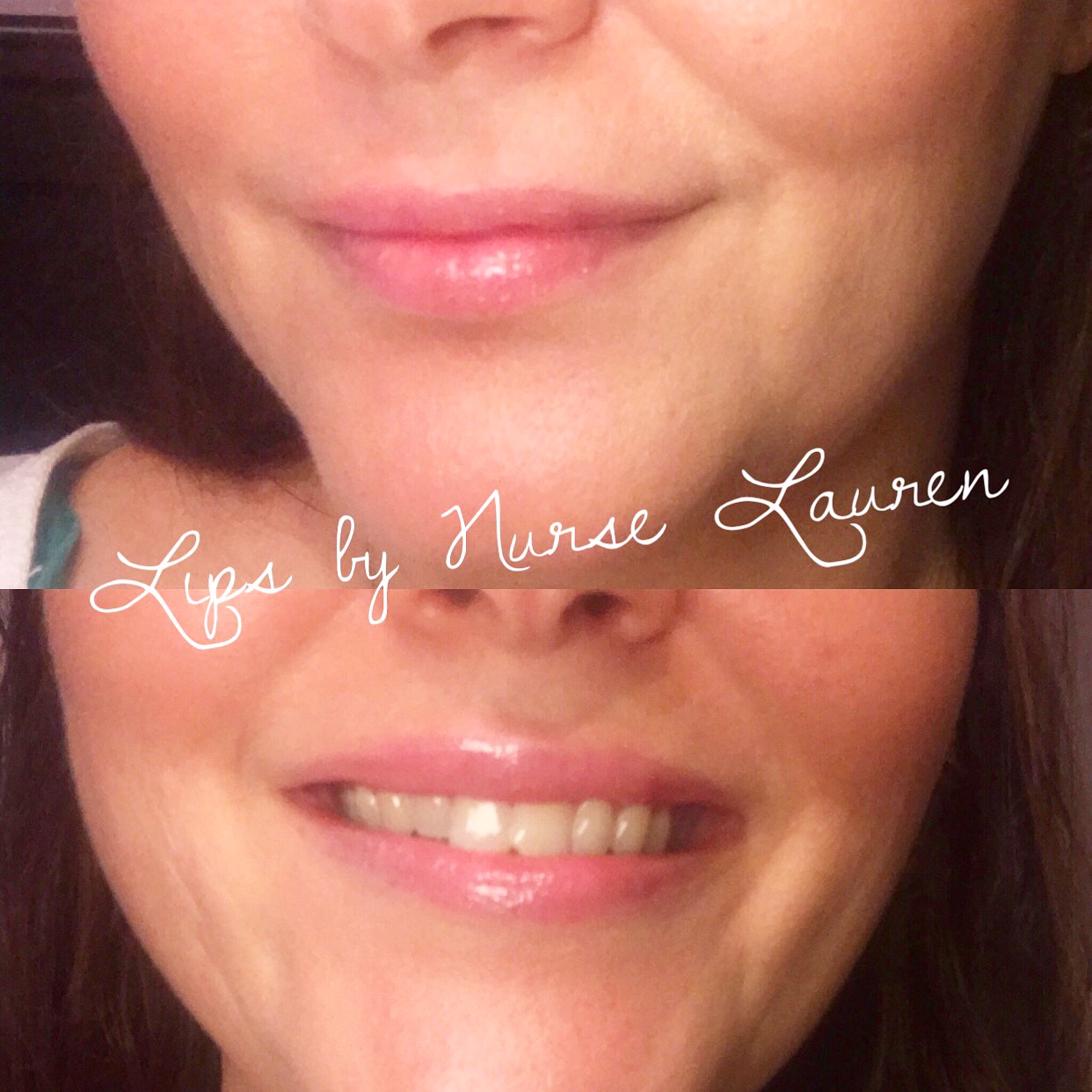 natural lips!
