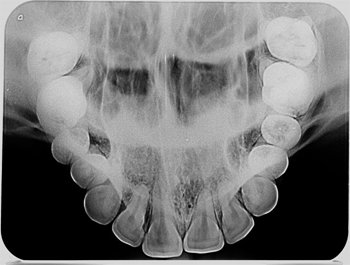 Radiografia Digital