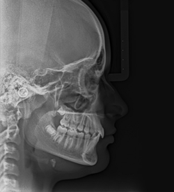 Radiografia Perfil