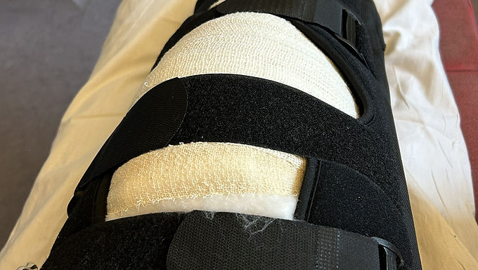 My knee replacement: The week-by-week reality