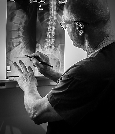 X ray Ruling Edited.png