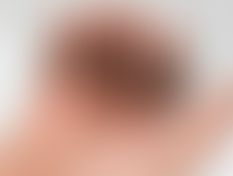 Can Men and Women Use the Same Hair Loss Treatments? Find the Best Options