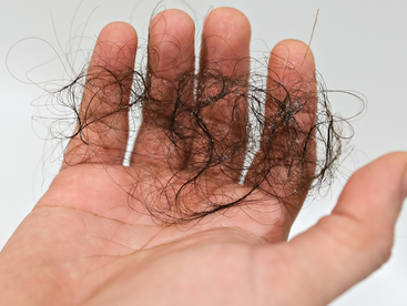 Can Men and Women Use the Same Hair Loss Treatments? Find the Best Options