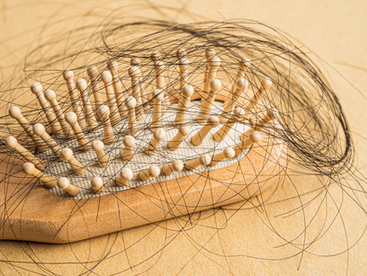 Over-the-Counter Hair Loss Treatments: Help or Hype? Find Out What Works