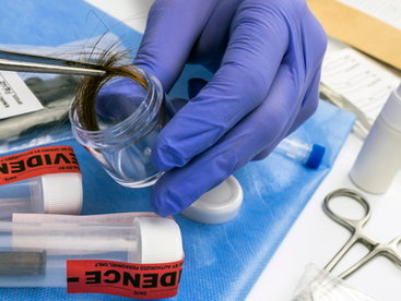 The Superiority of HTMA Over Blood Tests for Hair Loss and Scalp Concerns