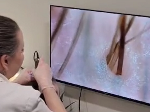 Trichologist consulting with a client during a scalp analysis at Restore Hair Loss & Scalp Clinic.