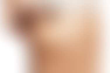 Como se livrar de uma vez, das terríveis celulites! 