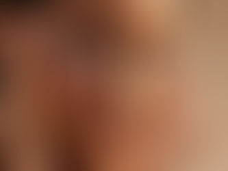 GÖZ ALTINA HASSAS BAKIM