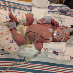 Life and Lessons From the NICU
