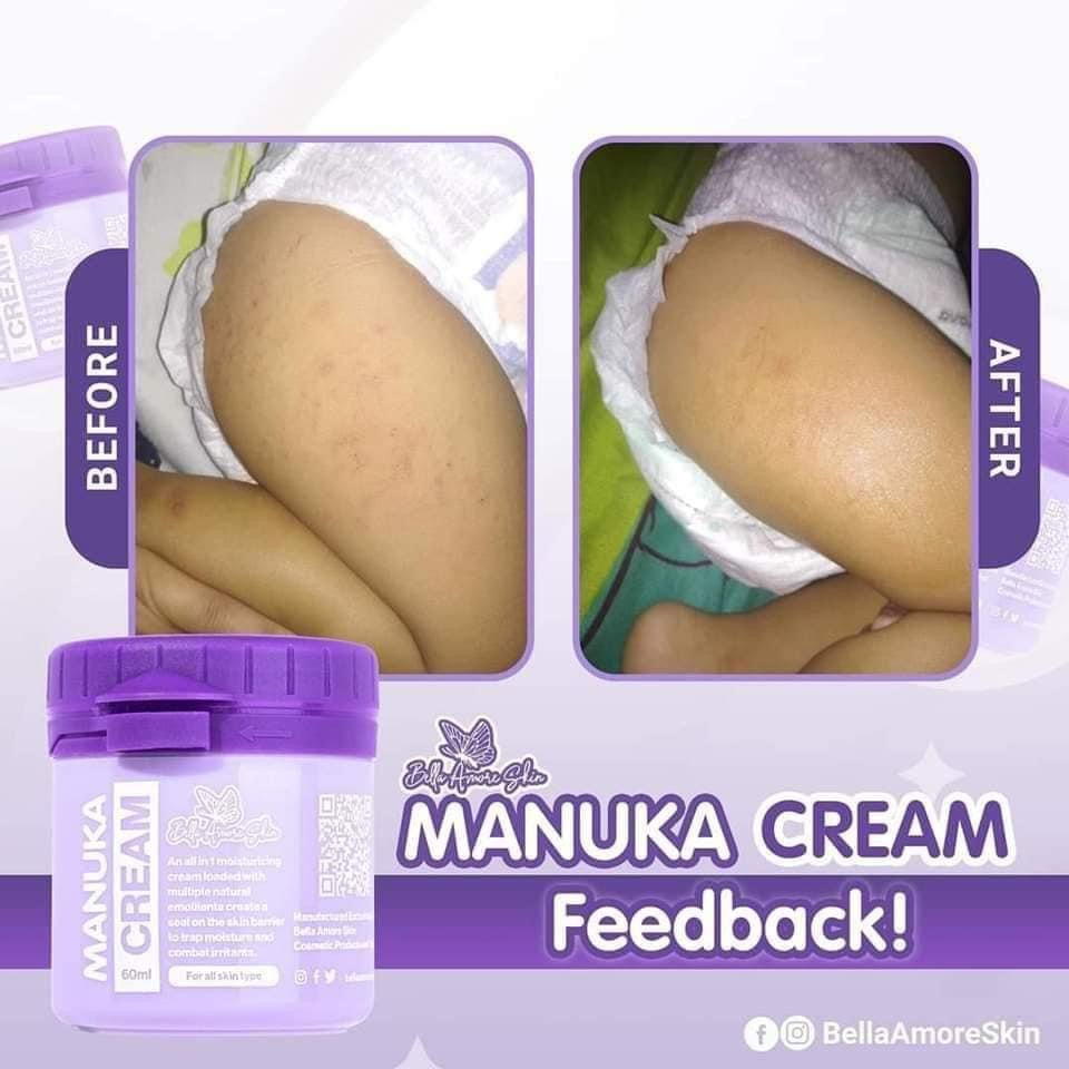 Thumbnail: Manuka Cream